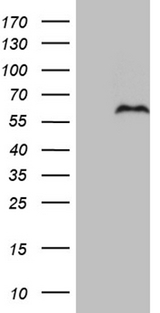PRRT2 Antibody - HEK293T cells were transfected with the pCMV6-ENTRY control. (Left lane) or pCMV6-ENTRY PRRT2. (Right lane) cDNA for 48 hrs and lysed. Equivalent amounts of cell lysates. (5 ug per lane) were separated by SDS-PAGE and immunoblotted with anti-PRRT2. (1:500)