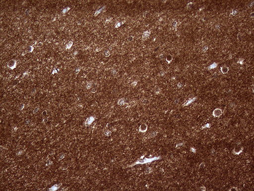 PRRT2 Antibody - Immunohistochemical staining of paraffin-embedded Human embryonic cerebellum within the normal limits using anti-PRRT2 mouse monoclonal antibody. (Heat-induced epitope retrieval by 1mM EDTA in 10mM Tris buffer. (pH8.5) at 120 oC for 3 min. (1:2000)