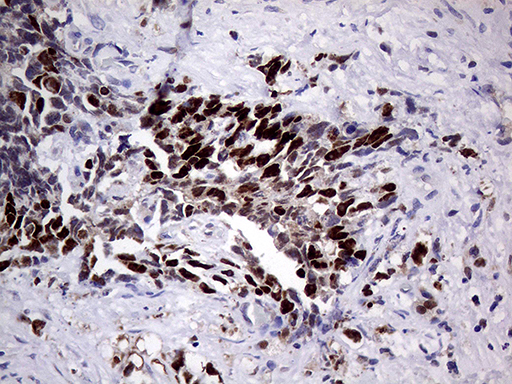 PRRT2 Antibody - Immunohistochemical staining of paraffin-embedded Human placenta tissue within the normal limits using anti-PRRT2 mouse monoclonal antibody. (Heat-induced epitope retrieval by 1mM EDTA in 10mM Tris buffer. (pH8.5) at 120 oC for 3 min. (1:2000)