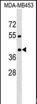 PRRT2 Antibody - PRRT2 Antibody western blot of MDA-MB453 cell line lysates (35 ug/lane). The PRRT2 antibody detected the PRRT2 protein (arrow).