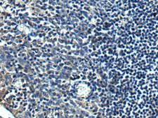 PRRT2 Antibody - Immunohistochemistry of paraffin-embedded Human tonsil tissue  using PRRT2 Polyclonal Antibody at dilution of 1:40(×200)