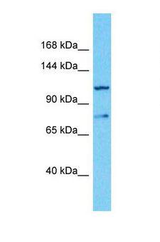 PRRT3 Antibody - Western blot of Human 721_B. PRRT3 antibody dilution 1.0 ug/ml.  This image was taken for the unconjugated form of this product. Other forms have not been tested.