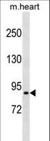 PRRT4 Antibody - PRRT4 Antibody western blot of mouse heart tissue lysates (35 ug/lane). The PRRT4 antibody detected the PRRT4 protein (arrow).