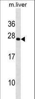 PRRX2 / PRX2 Antibody - PRRX2 Antibody western blot of mouse liver tissue lysates (35 ug/lane). The PRRX2 antibody detected the PRRX2 protein (arrow).