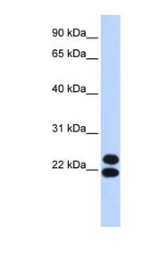 PRRX2 / PRX2 Antibody - PRRX2 antibody Western blot of 293T cell lysate. This image was taken for the unconjugated form of this product. Other forms have not been tested.