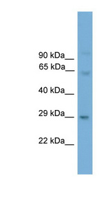 PRRX2 / PRX2 Antibody - PRRX2 antibody Western blot of Mouse Spleen lysate. This image was taken for the unconjugated form of this product. Other forms have not been tested.