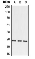 PRRX2 / PRX2 Antibody - Western blot analysis of PRRX2 expression in HEK293T (A); SP2/0 (B); PC12 (C) whole cell lysates.