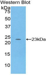 PRSS1 / Trypsin Antibody - Western blot of recombinant PRSS1 / Trypsin.  This image was taken for the unconjugated form of this product. Other forms have not been tested.
