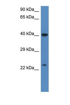 PRSS1 / Trypsin Antibody - PRSS1 / Trypsin antibody Western blot of HT1080 Cell lysate. Antibody concentration 1 ug/ml.  This image was taken for the unconjugated form of this product. Other forms have not been tested.