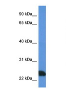 PRSS1 / Trypsin Antibody - PRSS1 / Trypsin antibody Western blot of Jurkat Cell lysate. Antibody concentration 1 ug/ml.  This image was taken for the unconjugated form of this product. Other forms have not been tested.