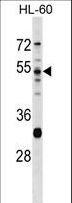 PRSS16 Antibody - PRSS16 Antibody western blot of HL-60 cell line lysates (35 ug/lane). The PRSS16 antibody detected the PRSS16 protein (arrow).