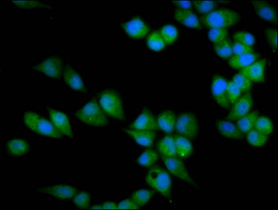 PRSS16 Antibody - Immunofluorescence staining of Hela cells diluted at 1:133, counter-stained with DAPI. The cells were fixed in 4% formaldehyde, permeabilized using 0.2% Triton X-100 and blocked in 10% normal Goat Serum. The cells were then incubated with the antibody overnight at 4°C.The Secondary antibody was Alexa Fluor 488-congugated AffiniPure Goat Anti-Rabbit IgG (H+L).