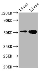 PRSS16 Antibody - Western Blot Positive WB detected in: Rat liver tissue, Mouse liver tissue All Lanes: PRSS16 antibody at 3.2µg/ml Secondary Goat polyclonal to rabbit IgG at 1/50000 dilution Predicted band size: 56 KDa Observed band size: 56 KDa