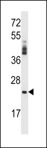 PRSS2 / Trypsin 2 Antibody - PRSS2 Antibody western blot of NCI-H292 cell line lysates (35 ug/lane). The PRSS2 antibody detected the PRSS2 protein (arrow).