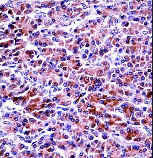 PRSS2 / Trypsin 2 Antibody - PRSS2 Antibody immunohistochemistry of formalin-fixed and paraffin-embedded human pancreas tissue followed by peroxidase-conjugated secondary antibody and DAB staining.
