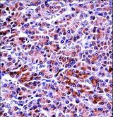 PRSS2 / Trypsin 2 Antibody - PRSS2 Antibody immunohistochemistry of formalin-fixed and paraffin-embedded human pancreas tissue followed by peroxidase-conjugated secondary antibody and DAB staining.