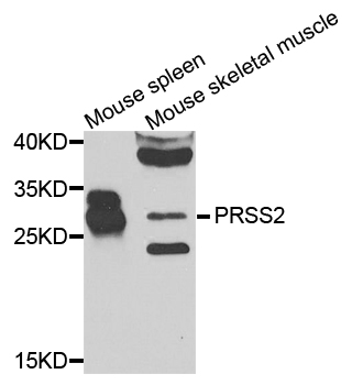 PRSS2 / Trypsin 2 Antibody - Western blot analysis of extracts of mouse tissues.