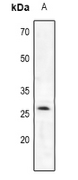 PRSS2 / Trypsin 2 Antibody - Western blot analysis of Trypsin 2 expression in HT102 (A), SW620 (B), CT26 (C), PC12 (D) whole cell lysates.