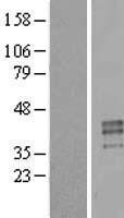 PRSS21 / Testisin Protein - Western validation with an anti-DDK antibody * L: Control HEK293 lysate R: Over-expression lysate