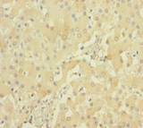 PRSS23 Antibody - Immunohistochemistry of paraffin-embedded human liver tissue using PRSS23 Antibody at dilution of 1:100