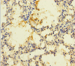 PRSS23 Antibody - Immunohistochemistry of paraffin-embedded human lung tissue using PRSS23 Antibody at dilution of 1:100