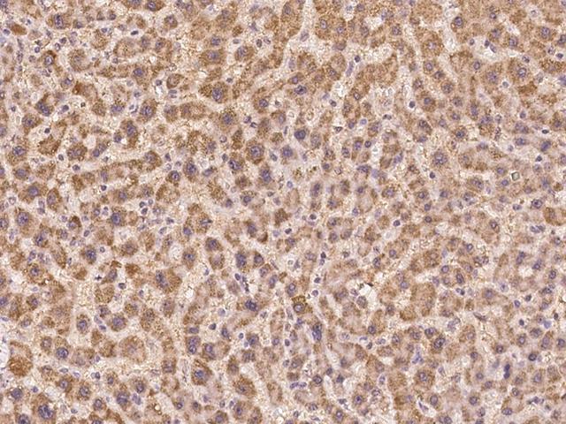 PRSS23 Antibody - Immunochemical staining of human PRSS23 in human liver with rabbit polyclonal antibody at 1:100 dilution, formalin-fixed paraffin embedded sections.