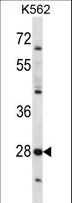PRSS27 / CAPH2 Antibody - PRSS27 Antibody western blot of K562 cell line lysates (35 ug/lane). The PRSS27 antibody detected the PRSS27 protein (arrow).