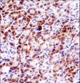 PRSS27 / CAPH2 Antibody - PRSS27 Antibody immunohistochemistry of formalin-fixed and paraffin-embedded human pancreas tissue followed by peroxidase-conjugated secondary antibody and DAB staining.