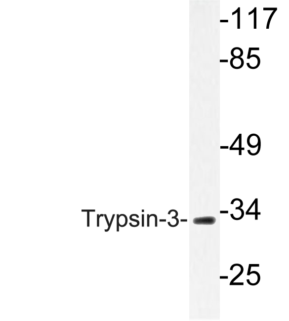 PRSS3 / Trypsin 3 Antibody - Western blot analysis of lysate from A549 cells, using Trypsin-3 antibody.