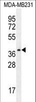 PRSS3 / Trypsin 3 Antibody - PRSS3 Antibody western blot of MDA-MB231 cell line lysates (35 ug/lane). The PRSS3 antibody detected the PRSS3 protein (arrow).