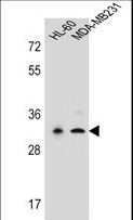 PRSS3 / Trypsin 3 Antibody - PRSS3 Antibody western blot of HL-60,MDA-MB231 cell line lysates (35 ug/lane). The PRSS3 antibody detected the PRSS3 protein (arrow).