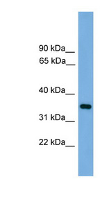 PRSS3 / Trypsin 3 Antibody - PRSS3 antibody western blot of Human muscle lysate.  This image was taken for the unconjugated form of this product. Other forms have not been tested.