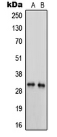 PRSS3 / Trypsin 3 Antibody - Western blot analysis of Trypsin 3 expression in MDAMB231 (A); HL60 (B) whole cell lysates.