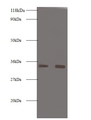 PRSS3 / Trypsin 3 Antibody - Western blot of Trypsin-3 antibody at 2 ug/ml. Lane 1: EC109 whole cell lysate. Lane 2: 293T whole cell lysate. Secondary: Goat polyclonal to rabbit IgG at 1:10000 dilution. Predicted band size: 33 kDa. Observed band size: 33 kDa.  This image was taken for the unconjugated form of this product. Other forms have not been tested.