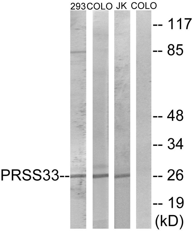 PRSS33 Antibody - Western blot analysis of lysates from COLO, 293, and Jurkat cells, using PRSS33 Antibody. The lane on the right is blocked with the synthesized peptide.