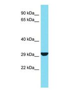 PRSS33 Antibody - Western blot of PRSS33 Antibody - C-terminal region with human 721_B cells lysate.  This image was taken for the unconjugated form of this product. Other forms have not been tested.
