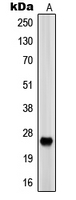 PRSS33 Antibody - Western blot analysis of EOS expression in HEK293 (A) whole cell lysates.