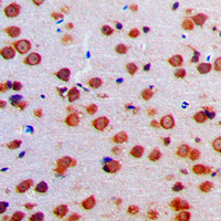 PRSS33 Antibody - Immunohistochemical analysis of EOS staining in human brain formalin fixed paraffin embedded tissue section. The section was pre-treated using heat mediated antigen retrieval with sodium citrate buffer (pH 6.0). The section was then incubated with the antibody at room temperature and detected using an HRP conjugated compact polymer system. DAB was used as the chromogen. The section was then counterstained with hematoxylin and mounted with DPX.