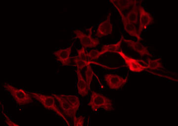 PRSS33 Antibody - Staining COLO205 cells by IF/ICC. The samples were fixed with PFA and permeabilized in 0.1% Triton X-100, then blocked in 10% serum for 45 min at 25°C. The primary antibody was diluted at 1:200 and incubated with the sample for 1 hour at 37°C. An Alexa Fluor 594 conjugated goat anti-rabbit IgG (H+L) Ab, diluted at 1/600, was used as the secondary antibody.