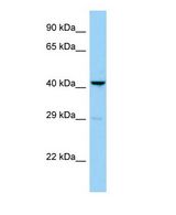 PRSS35 Antibody - Western blot of Prss35 Antibody - middle region in Mouse Lung cells lysate.  This image was taken for the unconjugated form of this product. Other forms have not been tested.