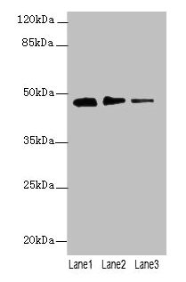 PRSS35 Antibody - Western blot All lanes: PRSS35 antibody at 0.2µg/ml Lane 1: PC-3 whole cell lysate Lane 2: NIH/3T3 whole cell lysate Lane 3: Mouse stomach tissue Secondary Goat polyclonal to rabbit IgG at 1/10000 dilution Predicted band size: 47 kDa Observed band size: 47 kDa