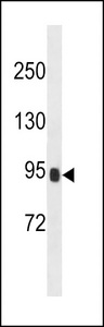 PRSS36 Antibody - PRSS36 Antibody western blot of NCI-H292 cell line lysates (35 ug/lane). The PRSS36 antibody detected the PRSS36 protein (arrow).