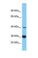 PRSS37 Antibody - Western blot of Human HepG2. PRSS37 antibody dilution 1.0 ug/ml.  This image was taken for the unconjugated form of this product. Other forms have not been tested.