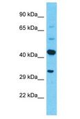 PRSS38 Antibody - PRSS38 antibody Western Blot of ACHN. Antibody dilution: 1 ug/ml.  This image was taken for the unconjugated form of this product. Other forms have not been tested.
