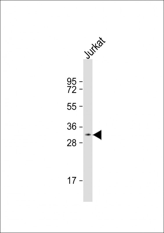 PRSS42 Antibody - Anti-PRSS42 Antibody (Center)at 1:500 dilution + Jurkat whole cell lysates Lysates/proteins at 20 ug per lane. Secondary Goat Anti-Rabbit IgG, (H+L), Peroxidase conjugated at 1:10000 dilution. Predicted band size: 32 kDa. Blocking/Dilution buffer: 5% NFDM/TBST.