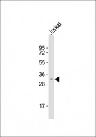 PRSS42 Antibody - Anti-PRSS42 Antibody (Center)at 1:500 dilution + Jurkat whole cell lysates Lysates/proteins at 20 ug per lane. Secondary Goat Anti-Rabbit IgG, (H+L), Peroxidase conjugated at 1:10000 dilution. Predicted band size: 32 kDa. Blocking/Dilution buffer: 5% NFDM/TBST.