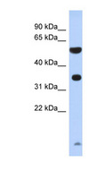 PRSS48 / ESSPL Antibody - PRSS48 / ESSPL antibody Western blot of Fetal Brain lysate. This image was taken for the unconjugated form of this product. Other forms have not been tested.