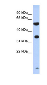 PRSS48 / ESSPL Antibody - PRSS48 / ESSPL antibody Western blot of Fetal Brain lysate. This image was taken for the unconjugated form of this product. Other forms have not been tested.