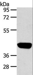 PRSS50 / TSP50 Antibody - Western blot analysis of Hepg2 cell, using PRSS50 Polyclonal Antibody at dilution of 1:450.
