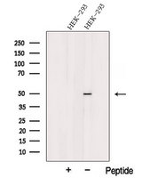 PRSS50 / TSP50 Antibody - Western blot analysis of extracts of HEK293 cells using TSP50 antibody. The lane on the left was treated with blocking peptide.